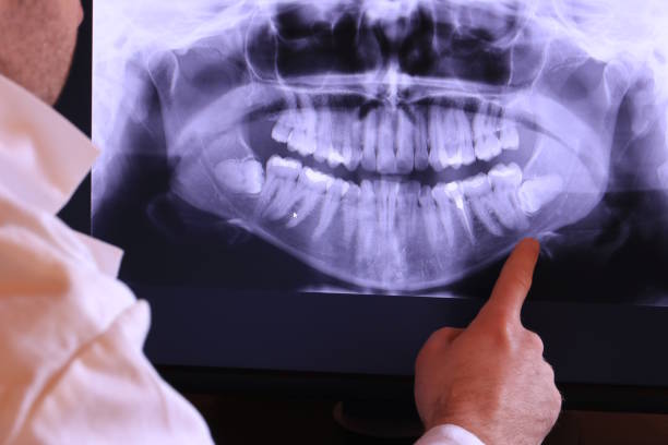 Best Emergency Gum Treatment in Paris, MO